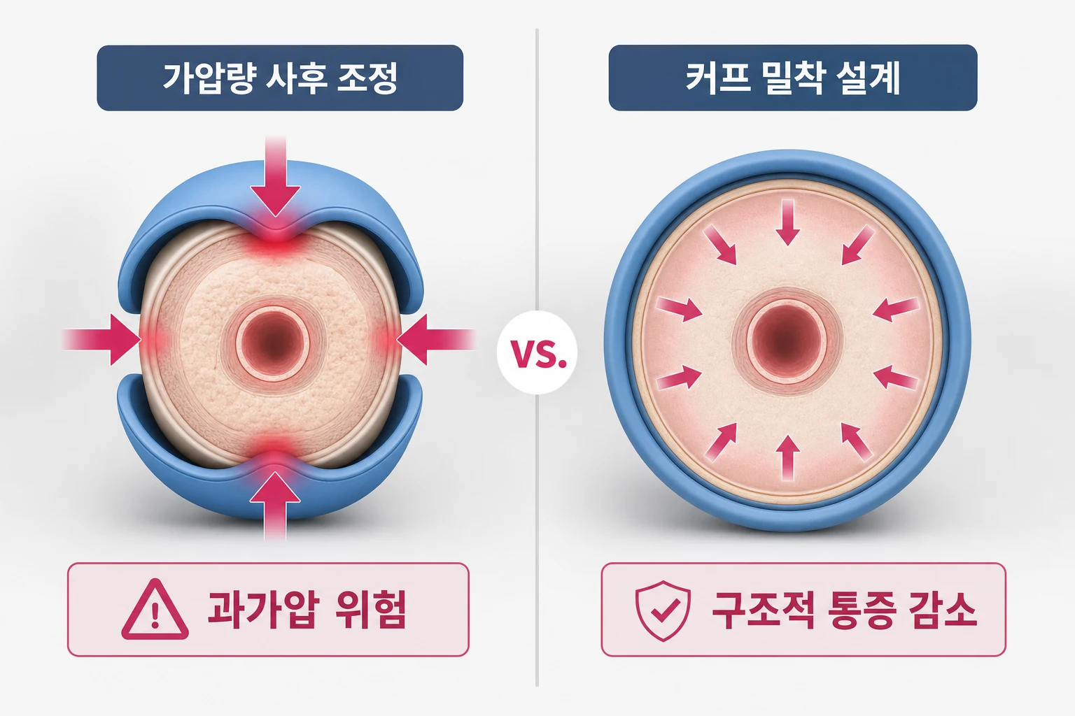 가압량 사후 조정 방식과 커프 밀착 설계 방식의 커프 압박 구조 비교 다이어그램